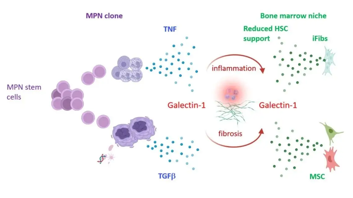 Revelan un nuevo rol de una molécula estudiada en la Argentina: la galectina-1 también es clave en un cáncer hematológico

